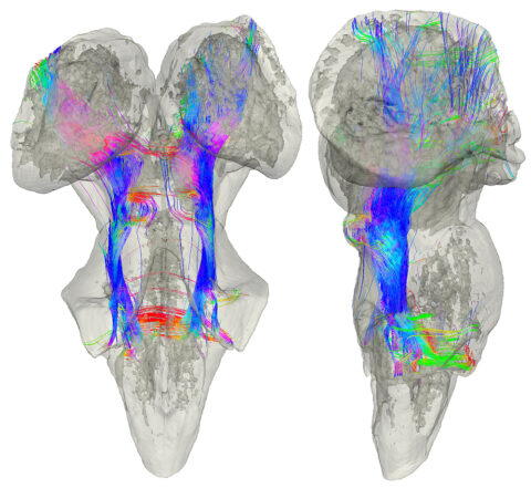 Diffusion MRI Tractography of the Human Subcortical Auditory Pathway by Kevin Sitek