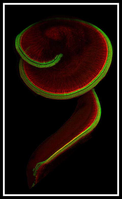 Hair Cells and Neurons of the Cochlea by Carl Nist-Lund