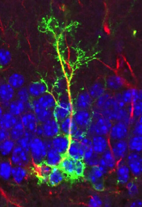 Neural Stem Cell in the Subgranular Zone of the DG by Cinzia Vicidomini