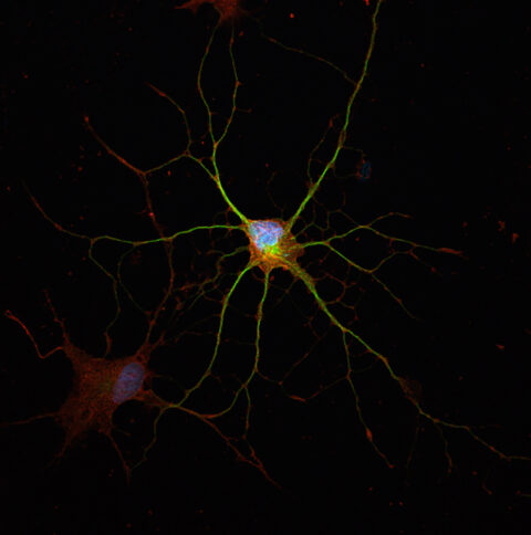 From Human Adult Fibroblast to CA3 Neuron by Haley Zanga