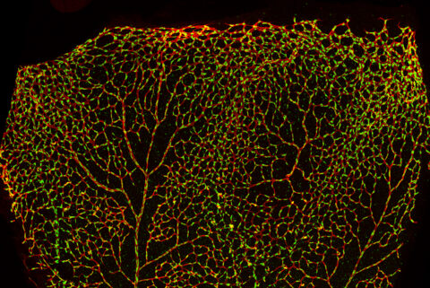 Blood Vessels in the Developing Retina by Swathi Ayloo