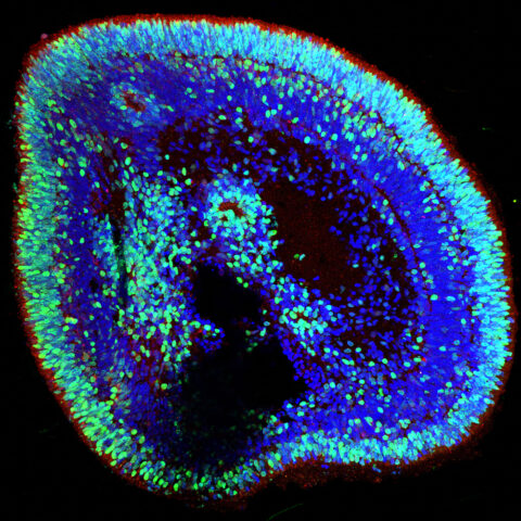 Human Retinal Organoids to Study the Underlying Causes of Spinocerebellar Ataxia 7 by Patrick Ovando-Roche