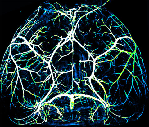 The Circle of Willis by Brian Chow