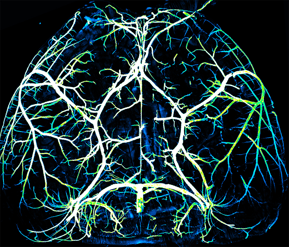 the circle of willis