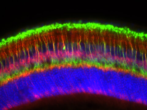 Neurons Within the Mouse Retina by Nicholas Hanovice
