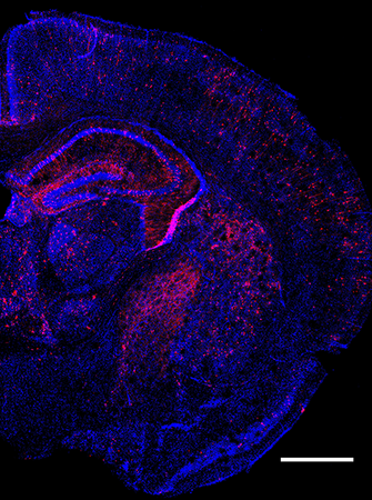 Coronal image of the mouse brain