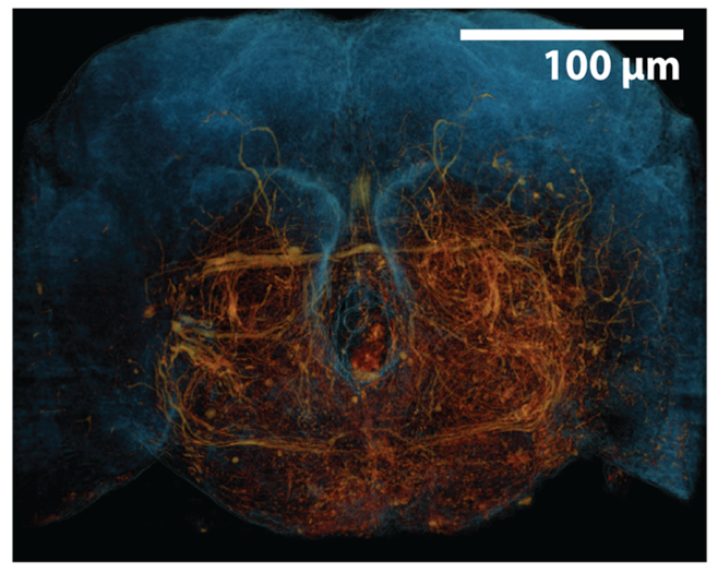 3D rendering of a fruit fly brain generated through x-ray holographic nano-tomography (XNH). The tissue outline is shown in blue, while neurons are highlighted in orange.