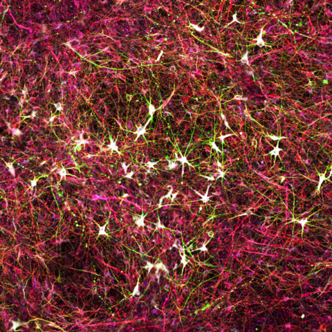 Twinkle Stars in Alzheimer’s In-a-Dish by Sang Su Kwak