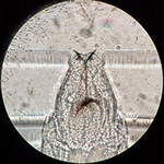 Head of larvae under the microscope.