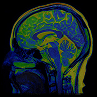 Brain MRI Scan of Healthy Male ( Magnetic Resonance Imaging) High Resolution