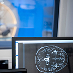 Photo of a computer screen with an MRI of a human brain