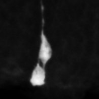 A pair of newborn cortical interneuron progenitors in the brain of a mouse embryo