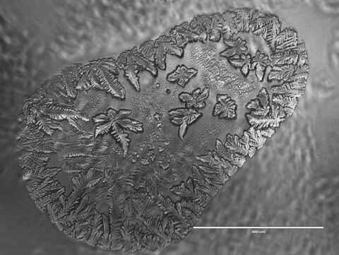 Accidental Crystallization of Cell Media Solution on Culture Dishes