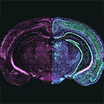 Grp mRNA (magenta) was visualized in a coronal slice of the mouse brain using fluorescent in situ hybridization. Two additional common markers were added in the right hemisphere for better visualization of cortical and hippocampal brain areas.