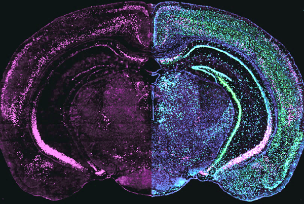 Grp mRNA (magenta) was visualized in a coronal slice of the mouse brain using fluorescent in situ hybridization. Two additional common markers were added in the right hemisphere for better visualization of cortical and hippocampal brain areas.