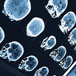 a collage of MRI scans