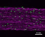 Natural Killer Cells thumbnail