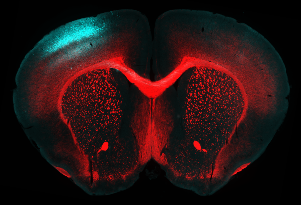 This image shows a cross-section of the brain from a young mouse.