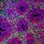 Organoid_Arlotta_Lab
