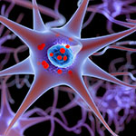 alt="Illustration shows neurons containing deposits of alpha-synuclein (indicated with small red spheres) that have accumulated in the brain cells.