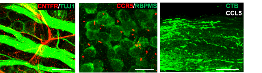 image showing portion of the mouse retina showing that the CNTFR (red), the receptor through which CNTF acts, is not present in retinal ganglion cells (RGCs) or their axons (green). Other experiments show that the cells that express the receptor are astrocytes