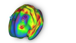 The “targeting atlas” derived in Siddiqi et al.’s recent study