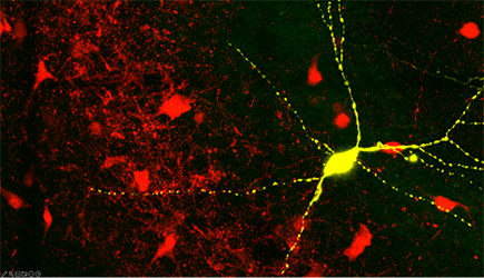 Shown in yellow is a biocytin filled parvalbumin interneuron in the hippocampus of an adult mouse (CA3/CA2 region). The red cells are other parvalbumin interneurons.