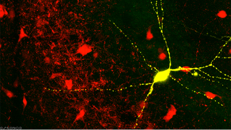 Shown in yellow is a biocytin filled parvalbumin interneuron in the hippocampus of an adult mouse (CA3/CA2 region). The red cells are other parvalbumin interneurons. 