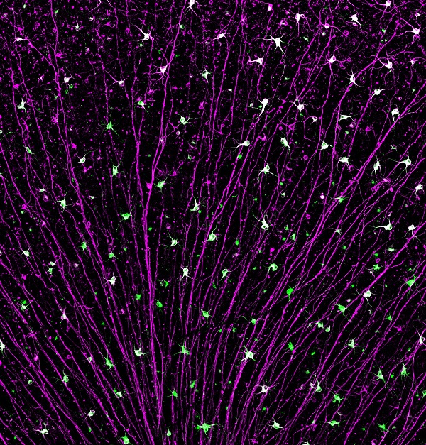 Portion of a mouse retina showing surviving retinal ganglion cells following injury to the optic nerve.