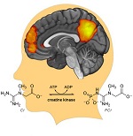 illustration showing nodes of a large-scale brain network