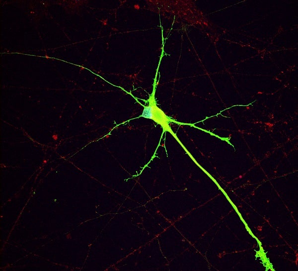 Human iPSC derived dopaminergic neuron with 16p11.2 deletion.