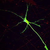 Human iPSC derived dopaminergic neuron with 16p11.2 deletion