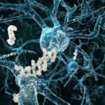 alzheimer's thumbnail