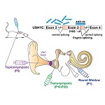 Illustration showing Usher Syndrome treatment.