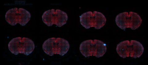 Slices Under Stress: Neuronal Activation in the Mouse Brain by PK Vincze