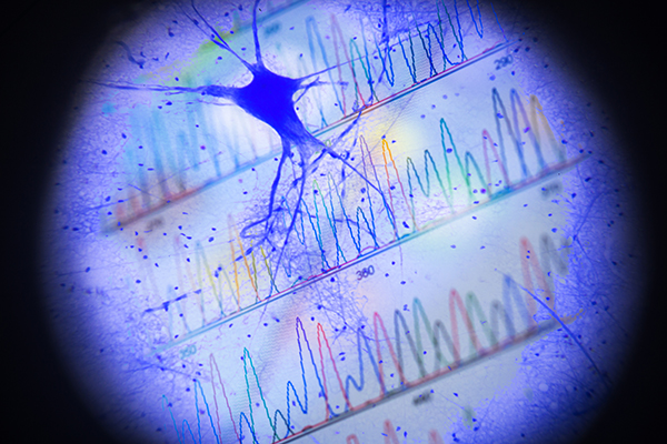motor nerve cells in microscopy with DNA peak