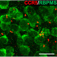 image showing portion of the mouse retina showing that the CNTFR (red), the receptor through which CNTF acts, is not present in retinal ganglion cells (RGCs) or their axons (green). Other experiments show that the cells that express the receptor are astrocytes