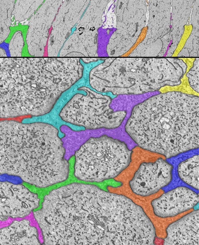 Electron microscope images showing Müller glial junctions in the human retina