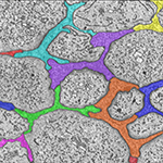 Electron microscope images showing Müller glial junctions in the human retina