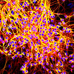 image depicting tau proteins associated with Parkinson's disease