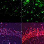 Top row: In a mouse model of Alzheimer's disease, lithium deficiency (right) dramatically increased amyloid beta deposits in the brain compared with mice that had normal physiological levels of lithium (left). Bottom row: The same was true for the Alzheimer’s neurofibrillary tangle protein tau. Images: Yankner Lab