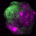 Human brain organoid showing the integration of excitatory (magenta) and inhibitory neurons (green) of the cerebral cortex