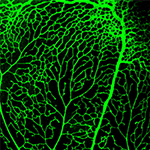 normal blood vessels in the retina