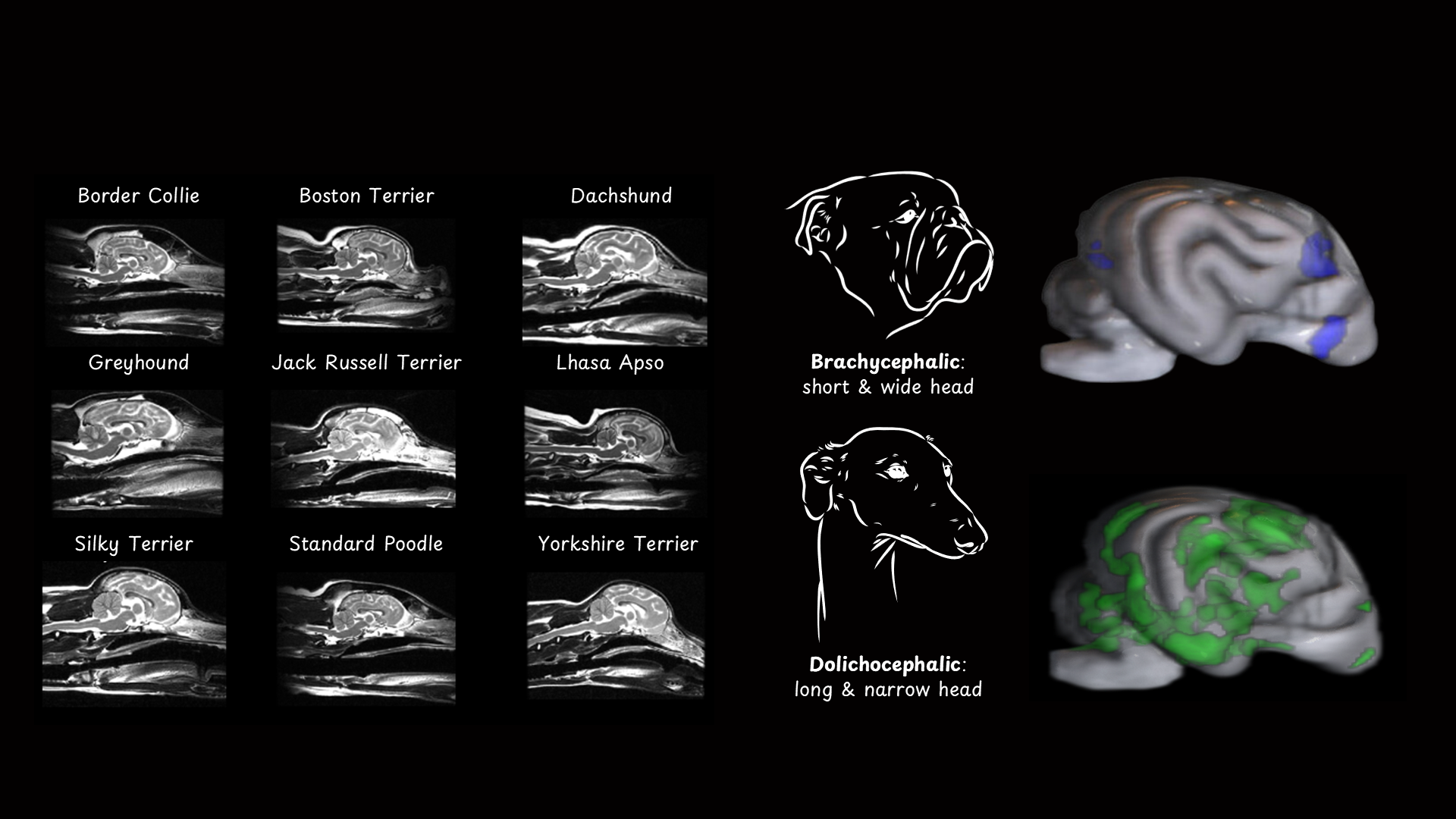 Sagittal images of dog brains with different skull shapes (left). Reduced regions of gray matter volume in extreme brachycephalic and dolichocephalic head shapes (right).