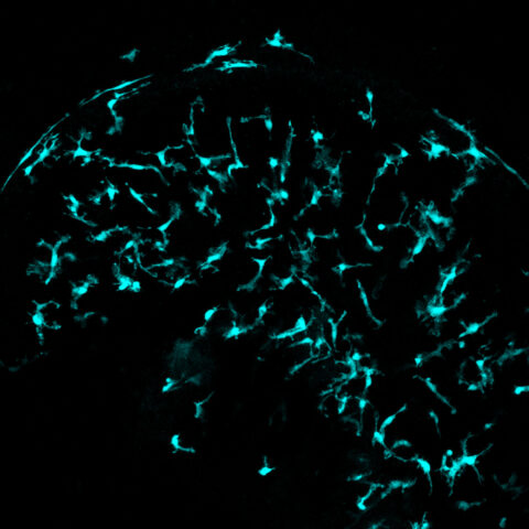 Immune Cell Surveillance by Katelyn Comeau Boulanger