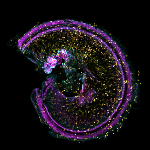 Cochlear Immune Cells Phagocytose Bacteria by Katelyn Comeau Boulanger,
