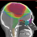 MRI-type image of brain scan, profile view