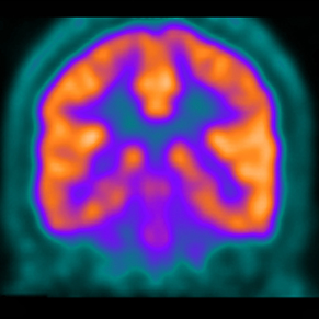 A colorful collage of purple, orange and turquoise images of a brain