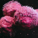malignant cancer cells