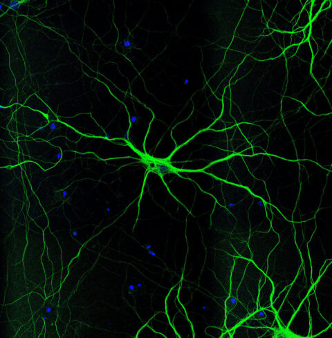 Tangled Tubules by Mara Casebeer